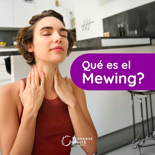 El Centre Dental Francesc Macià explica los secretos del movimiento Mewing 